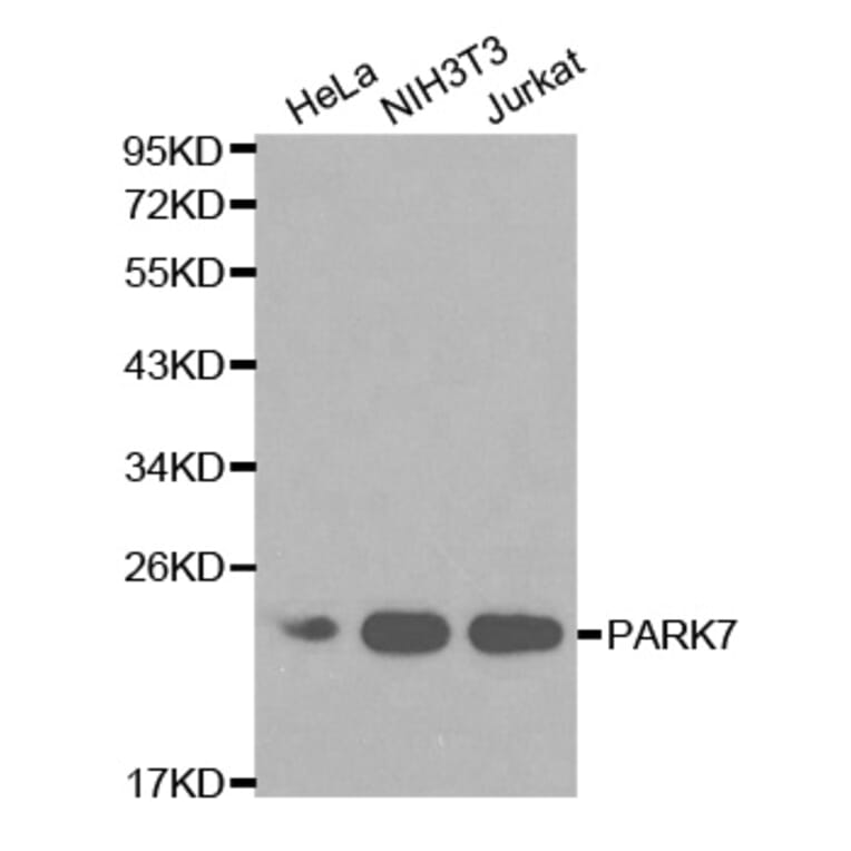 Western blot - PARK7 Antibody from Signalway Antibody (32112) - Antibodies.com