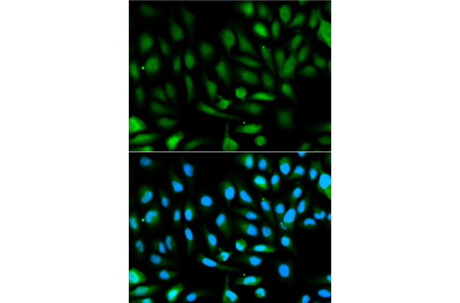 Immunofluorescence - PARK7 Antibody from Signalway Antibody (32112) - Antibodies.com