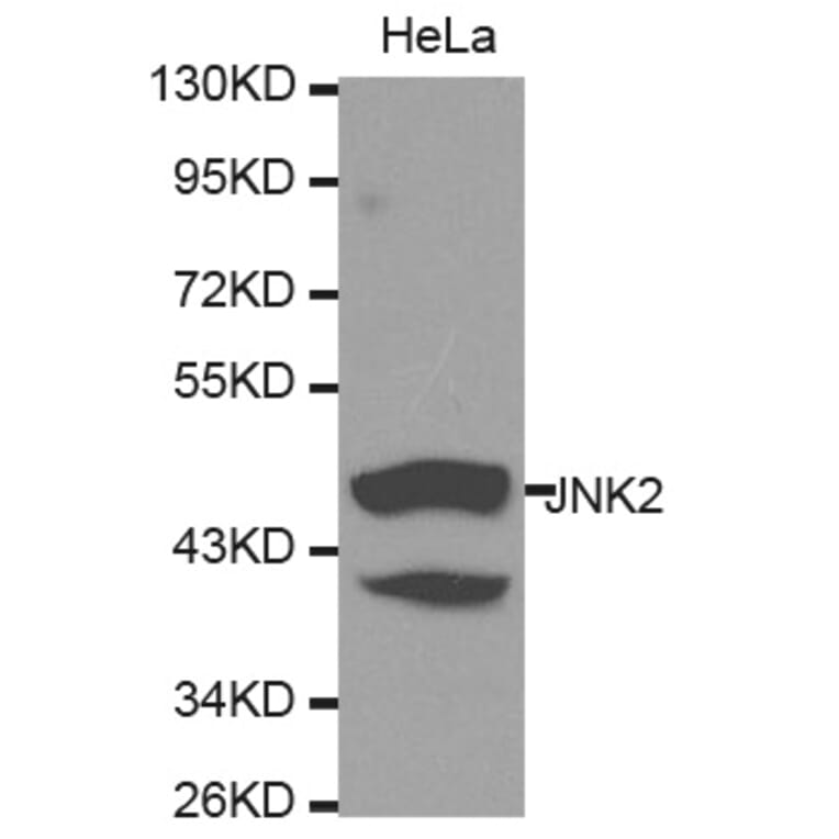 Western blot - MAPK9 Antibody from Signalway Antibody (32258) - Antibodies.com
