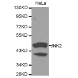 Western blot - MAPK9 Antibody from Signalway Antibody (32258) - Antibodies.com