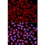 Immunofluorescence - MAPK9 Antibody from Signalway Antibody (32258) - Antibodies.com