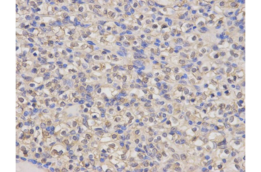 Immunohistochemistry - HMOX1 Antibody from Signalway Antibody (32266) - Antibodies.com
