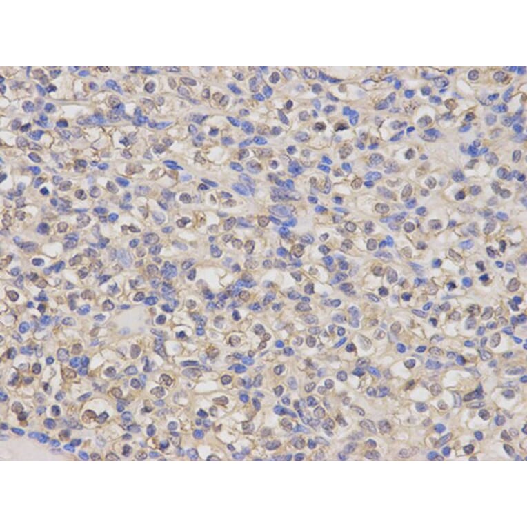 Immunohistochemistry - HMOX1 Antibody from Signalway Antibody (32266) - Antibodies.com