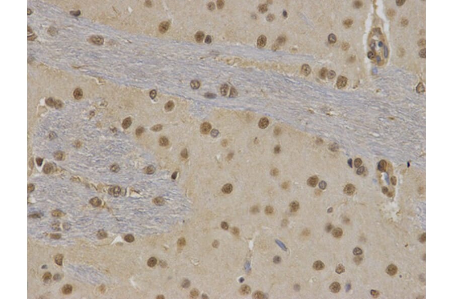 Immunohistochemistry - RUNX1 Antibody from Signalway Antibody (32574) - Antibodies.com