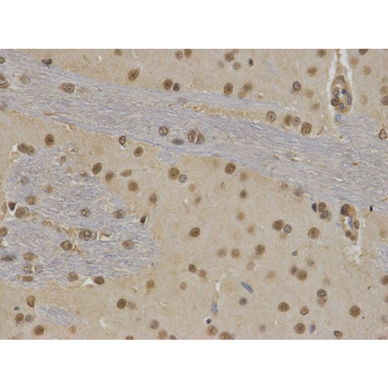 Immunohistochemistry - RUNX1 Antibody from Signalway Antibody (32574) - Antibodies.com