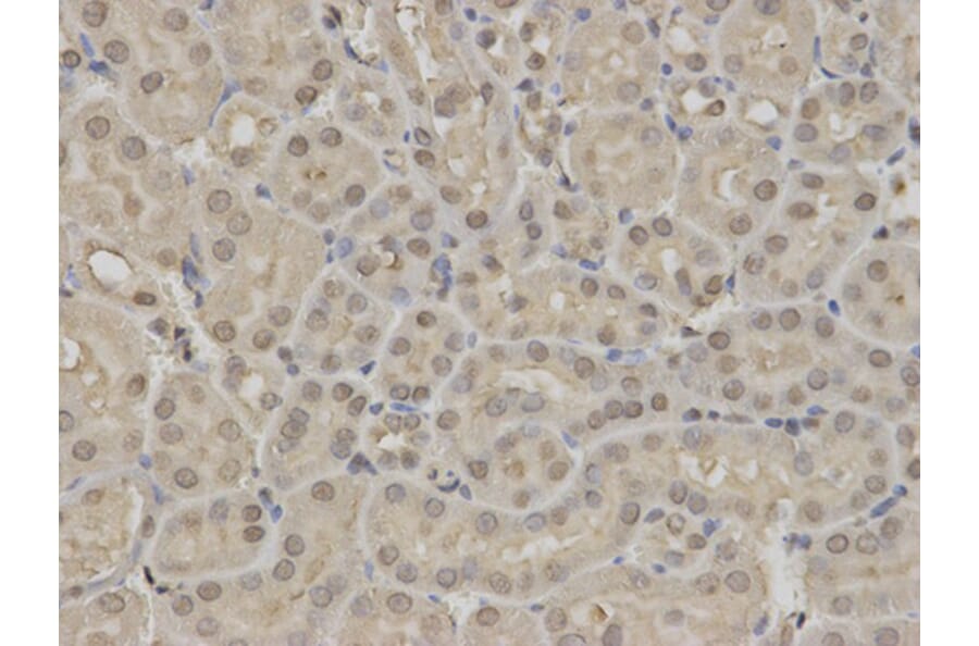 Immunohistochemistry - RUNX1 Antibody from Signalway Antibody (32574) - Antibodies.com