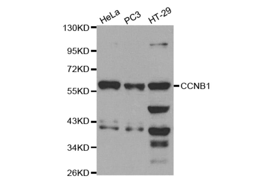 Western blot - CCNB1 Antibody from Signalway Antibody (32575) - Antibodies.com