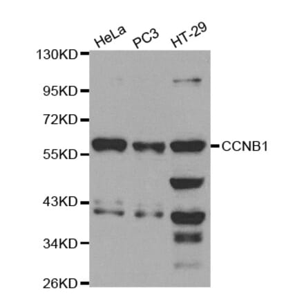 Western blot - CCNB1 Antibody from Signalway Antibody (32575) - Antibodies.com