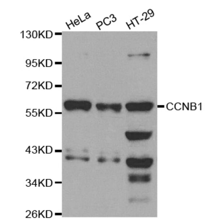Western blot - CCNB1 Antibody from Signalway Antibody (32575) - Antibodies.com