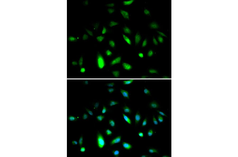 Immunofluorescence - CCNB1 Antibody from Signalway Antibody (32575) - Antibodies.com