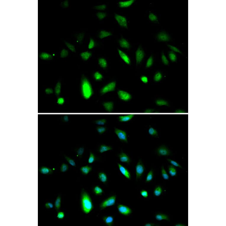 Immunofluorescence - CCNB1 Antibody from Signalway Antibody (32575) - Antibodies.com