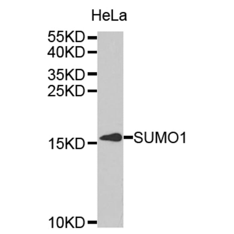 Western blot - SUMO1 Antibody from Signalway Antibody (32614) - Antibodies.com
