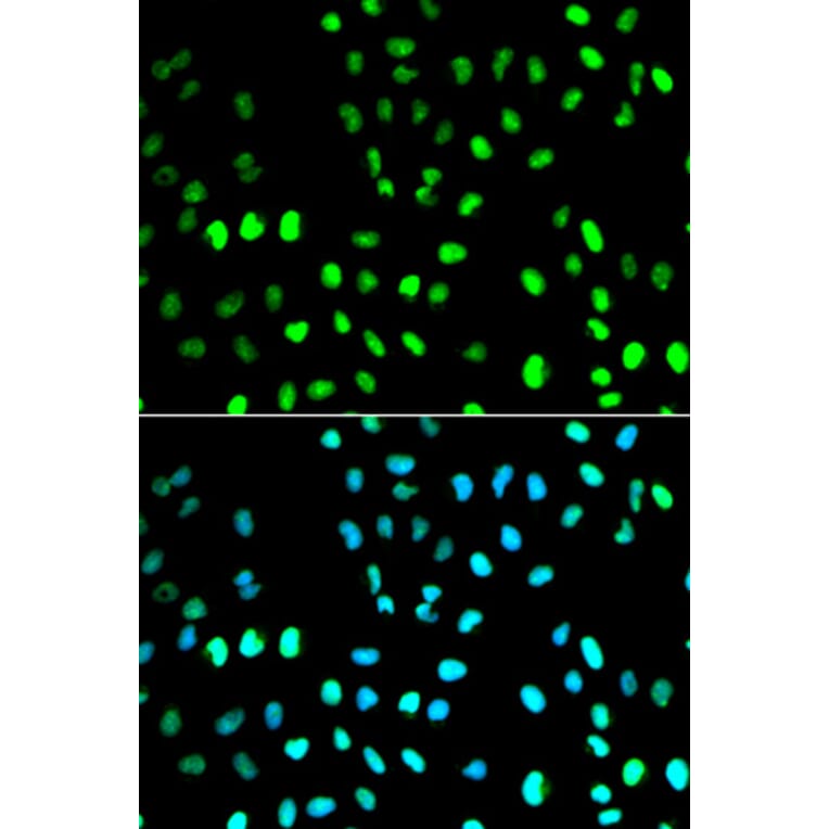Immunofluorescence - SUMO1 Antibody from Signalway Antibody (32614) - Antibodies.com