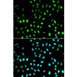 Immunofluorescence - SUMO1 Antibody from Signalway Antibody (32614) - Antibodies.com
