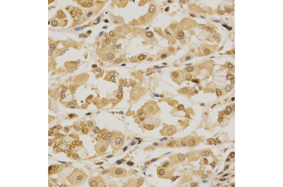 Immunohistochemistry - SUMO1 Antibody from Signalway Antibody (32614) - Antibodies.com