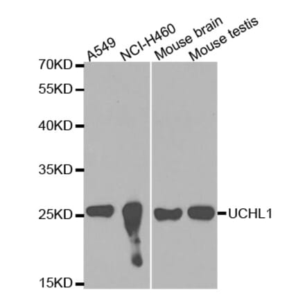 Western blot - UCHL1 Antibody from Signalway Antibody (32615) - Antibodies.com