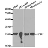 Western blot - UCHL1 Antibody from Signalway Antibody (32615) - Antibodies.com