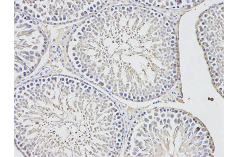 Immunohistochemistry - UCHL1 Antibody from Signalway Antibody (32615) - Antibodies.com