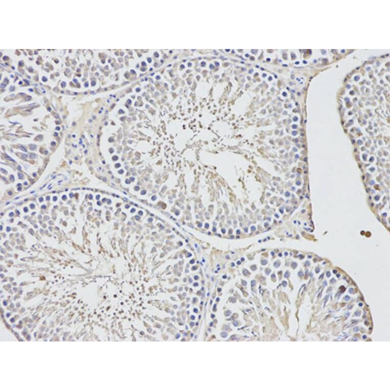 Immunohistochemistry - UCHL1 Antibody from Signalway Antibody (32615) - Antibodies.com
