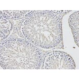 Immunohistochemistry - UCHL1 Antibody from Signalway Antibody (32615) - Antibodies.com
