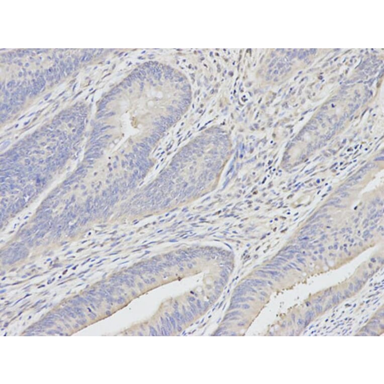 Immunohistochemistry - UCHL1 Antibody from Signalway Antibody (32615) - Antibodies.com
