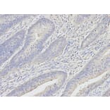 Immunohistochemistry - UCHL1 Antibody from Signalway Antibody (32615) - Antibodies.com