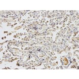 Immunohistochemistry - UCHL1 Antibody from Signalway Antibody (32615) - Antibodies.com