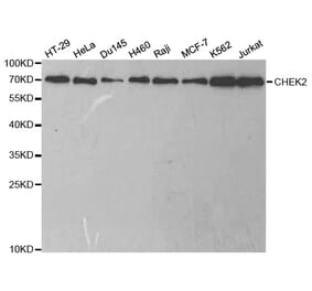 Western blot - CHEK2 Antibody from Signalway Antibody (32623) - Antibodies.com