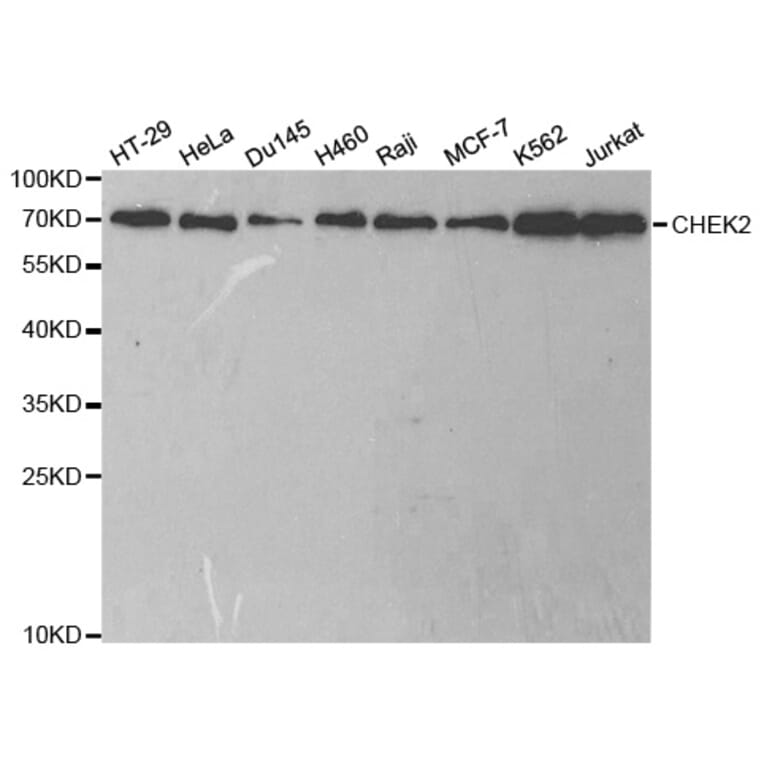 Western blot - CHEK2 Antibody from Signalway Antibody (32623) - Antibodies.com