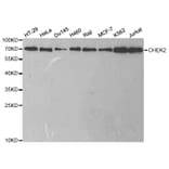 Western blot - CHEK2 Antibody from Signalway Antibody (32623) - Antibodies.com