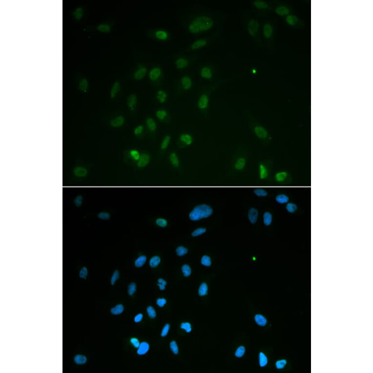 Immunofluorescence - CHEK2 Antibody from Signalway Antibody (32623) - Antibodies.com