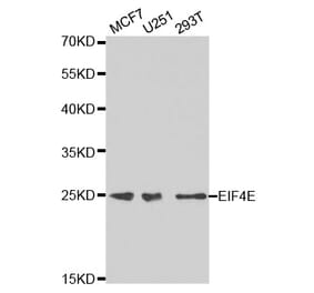 Western blot - EIF4E Antibody from Signalway Antibody (32632) - Antibodies.com