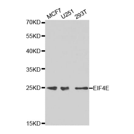 Western blot - EIF4E Antibody from Signalway Antibody (32632) - Antibodies.com