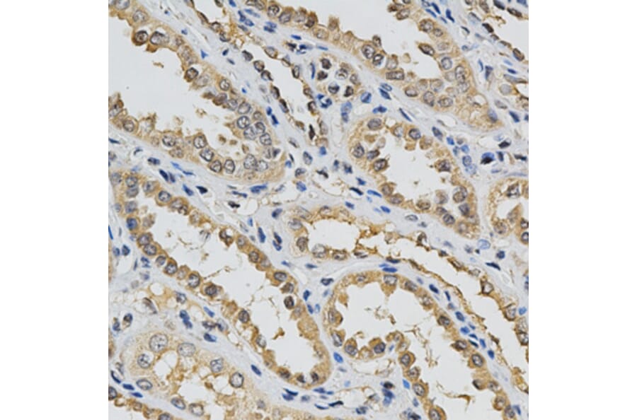 Immunohistochemistry - EIF4E Antibody from Signalway Antibody (32632) - Antibodies.com