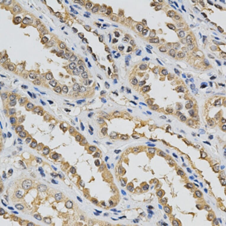 Immunohistochemistry - EIF4E Antibody from Signalway Antibody (32632) - Antibodies.com