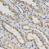 Immunohistochemistry - EIF4E Antibody from Signalway Antibody (32632) - Antibodies.com