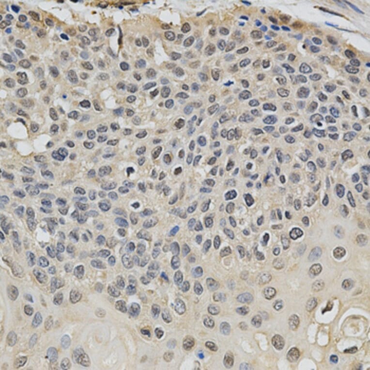 Immunohistochemistry - EIF4E Antibody from Signalway Antibody (32632) - Antibodies.com