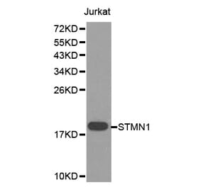 Western blot - STMN1 Antibody from Signalway Antibody (32643) - Antibodies.com