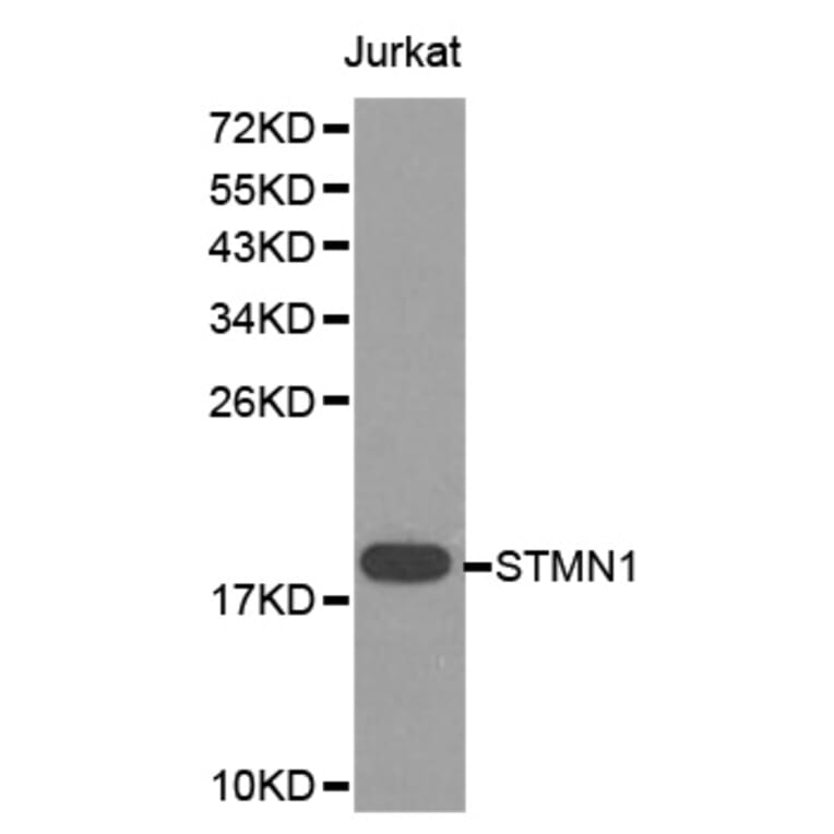 Western blot - STMN1 Antibody from Signalway Antibody (32643) - Antibodies.com