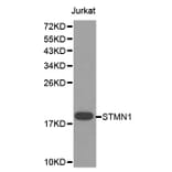 Western blot - STMN1 Antibody from Signalway Antibody (32643) - Antibodies.com