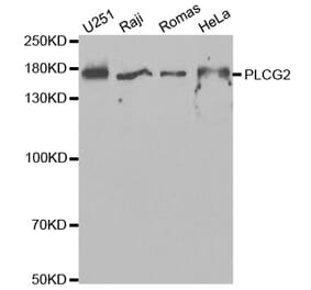 Western blot - PLCG2 Antibody from Signalway Antibody (32647) - Antibodies.com