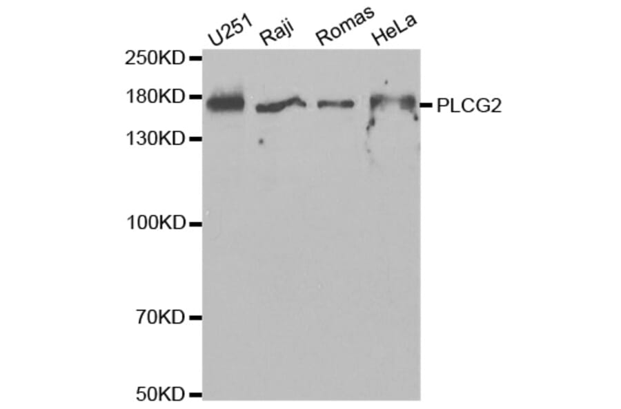 Western blot - PLCG2 Antibody from Signalway Antibody (32647) - Antibodies.com