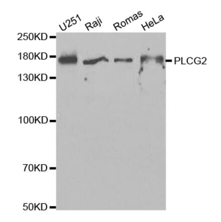 Western blot - PLCG2 Antibody from Signalway Antibody (32647) - Antibodies.com