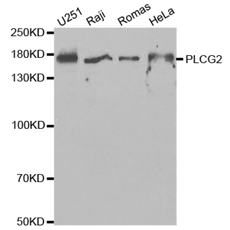 Western blot - PLCG2 Antibody from Signalway Antibody (32647) - Antibodies.com