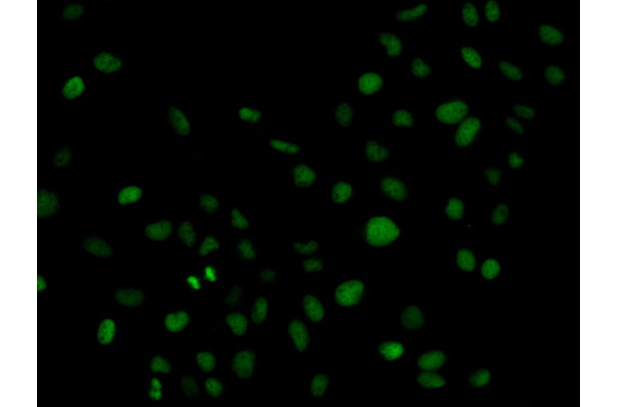 Immunofluorescence - PLCG2 Antibody from Signalway Antibody (32647) - Antibodies.com
