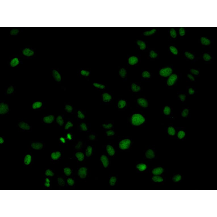 Immunofluorescence - PLCG2 Antibody from Signalway Antibody (32647) - Antibodies.com