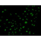 Immunofluorescence - PLCG2 Antibody from Signalway Antibody (32647) - Antibodies.com