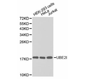 Western blot - UBE2I Antibody from Signalway Antibody (32656) - Antibodies.com