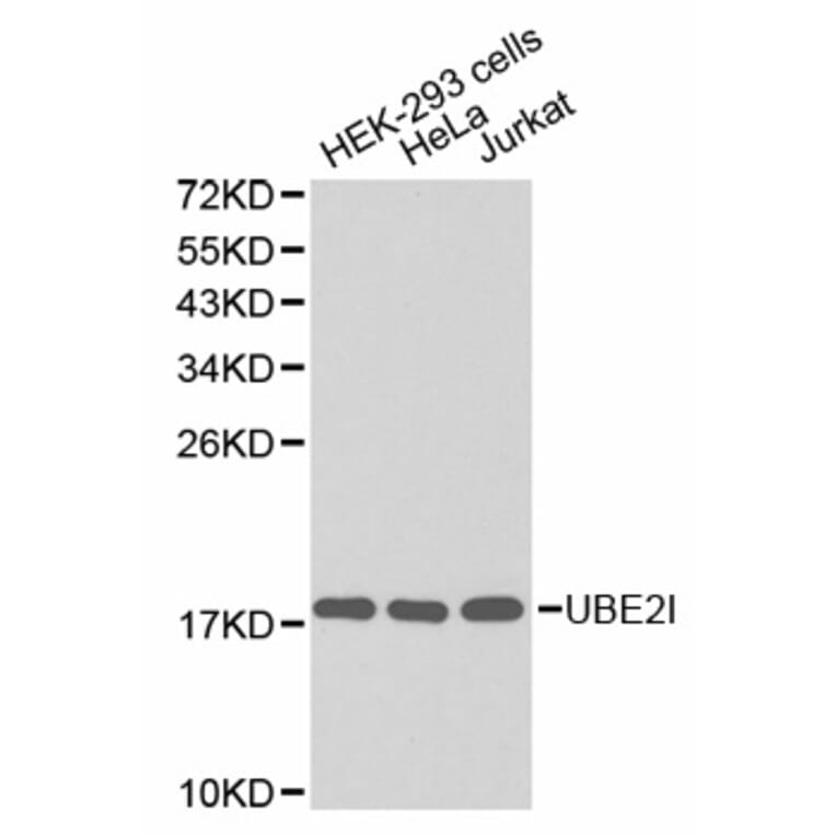 Western blot - UBE2I Antibody from Signalway Antibody (32656) - Antibodies.com