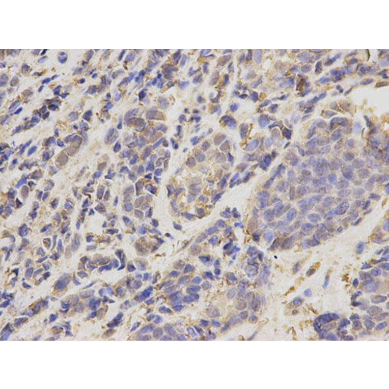 Immunohistochemistry - UBE2I Antibody from Signalway Antibody (32656) - Antibodies.com